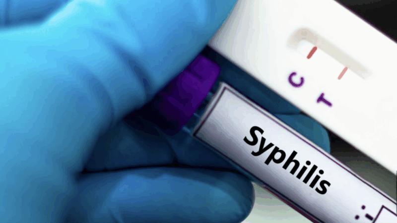 Quatre positius en els testos  d’hepatitis B, C, sífilis i VIH