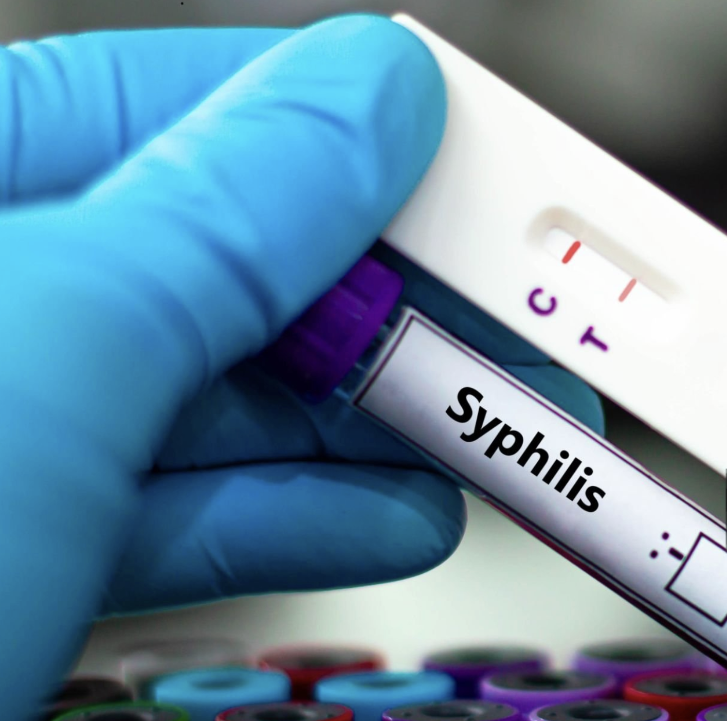 Quatre positius en els testos  d’hepatitis B, C, sífilis i VIH